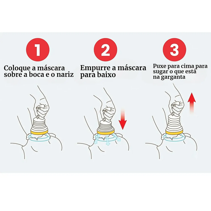 Kit Completo Antiengasgamento: Solução Rápida e Portátil para Emergências de Sufocamento!